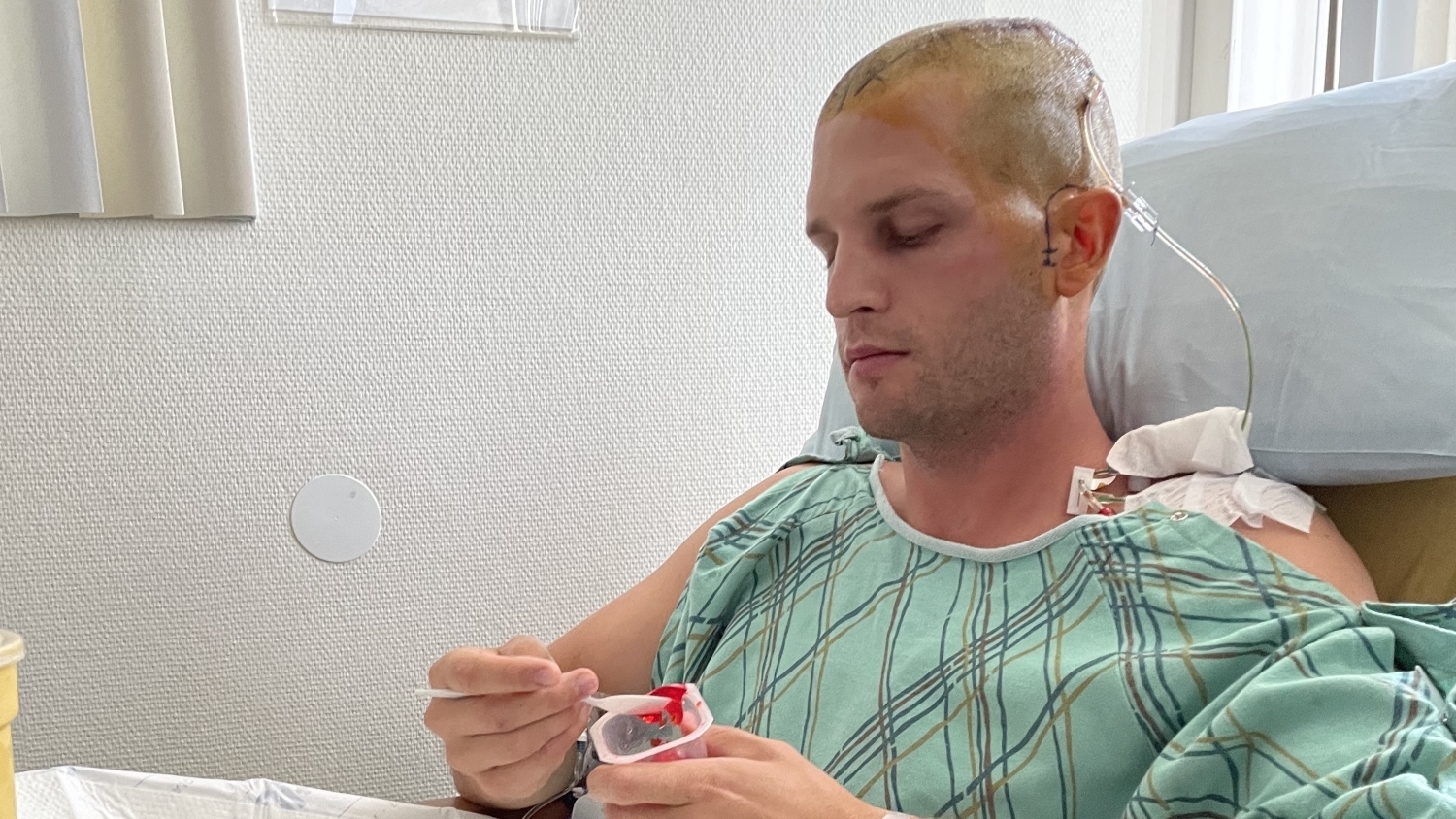 patient with traumatic brain injury eats jello in bed