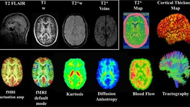 TBICoE Clinical Recommendation Training Series: Assessment of Dizziness and Visual Disturbances Following Concussion