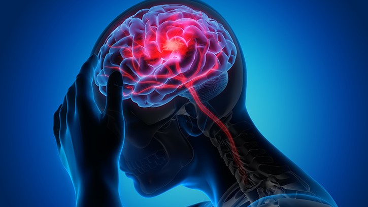 TBICoE Clinical Recommendation Training Series: Management of Headache Following Concussion