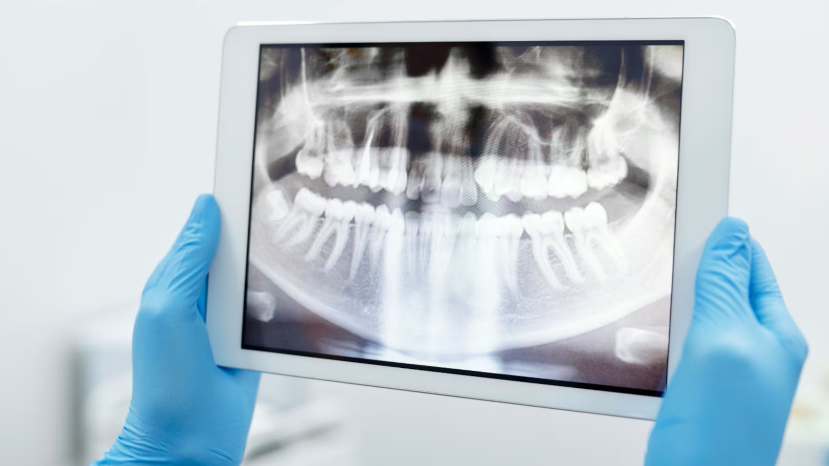 Image of dental technician holding up dental X-Rays