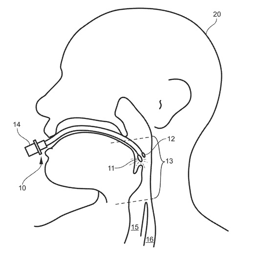 This drawing illustrates an expandable airway tube invented by Dr. Corinne Nawn and Dr. Brian Souhan that uses light to identify tracheal and esophageal tissue to ensure proper placement in a trachea. The Medical Research and Development Command’s Office of Medical Technology Transfer is working with Nawn and Souhan to develop and de-risk the device for licensing by small businesses operating in the medical device space.