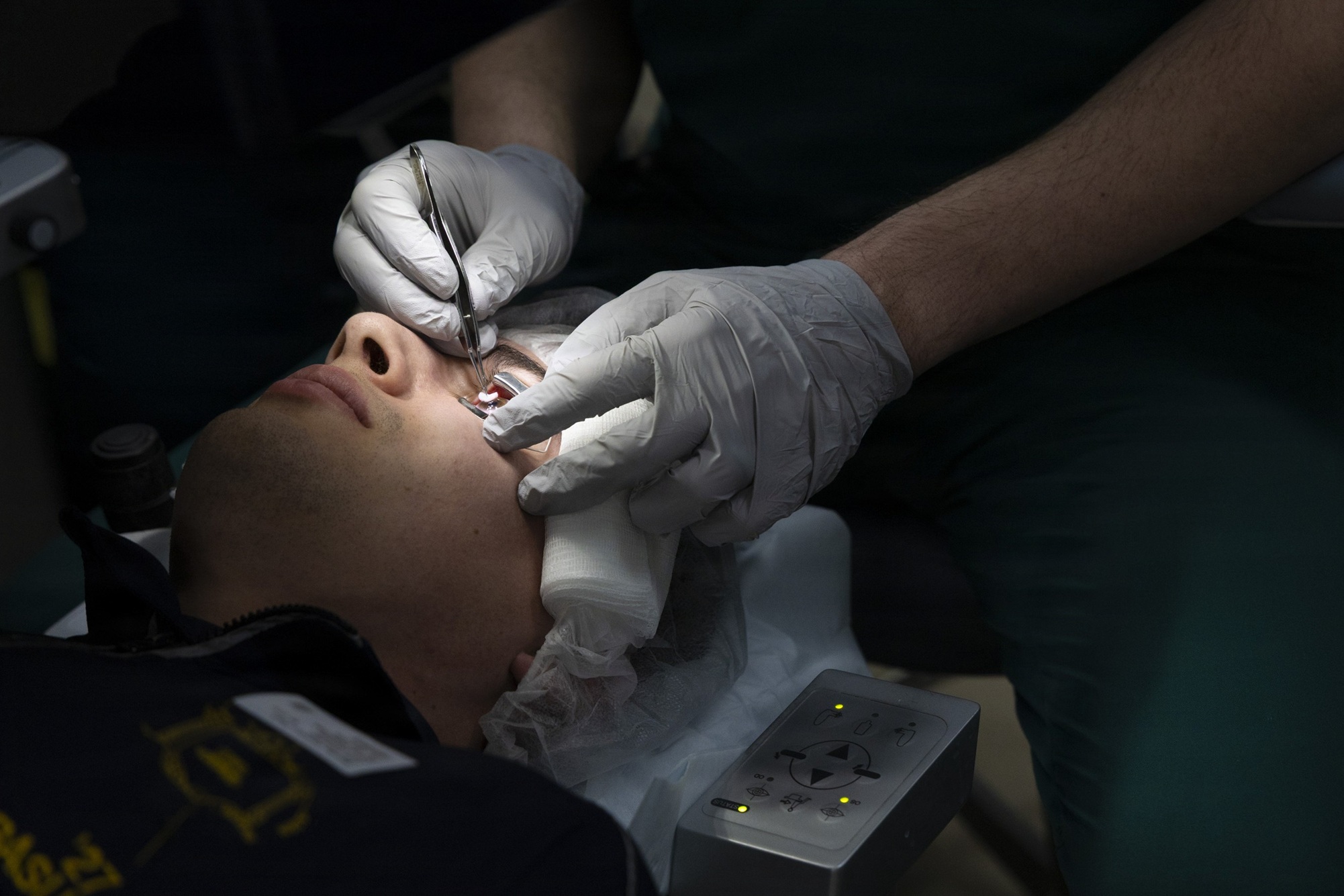 Ocular Trauma